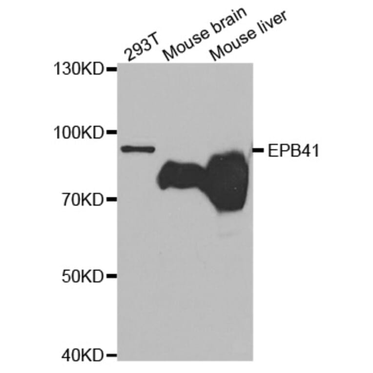 Anti-EPB41 Antibody from Bioworld Technology (BS7355) - Antibodies.com