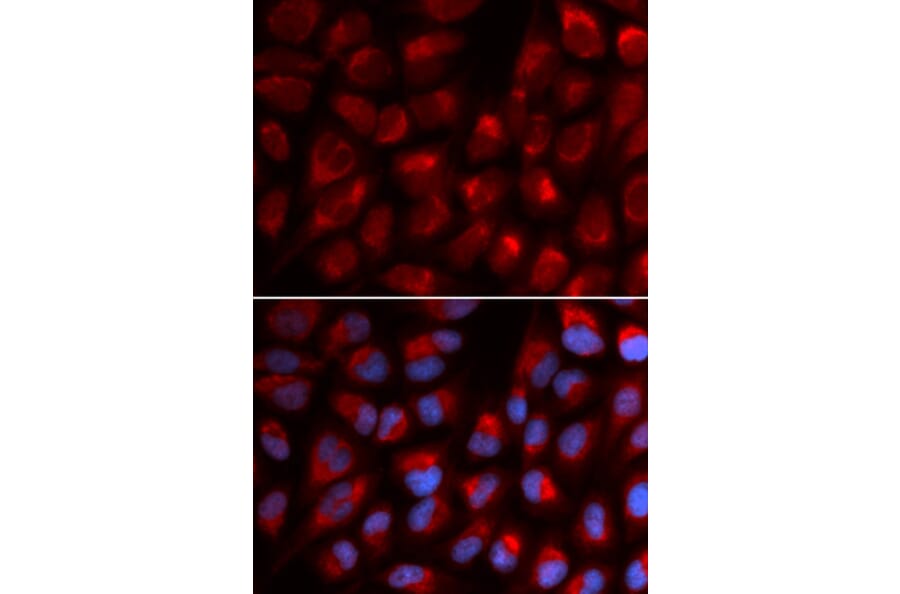 Anti-EPB41 Antibody from Bioworld Technology (BS7355) - Antibodies.com