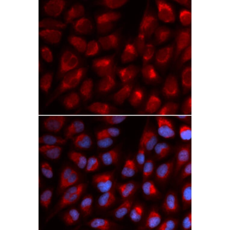 Anti-EPB41 Antibody from Bioworld Technology (BS7355) - Antibodies.com