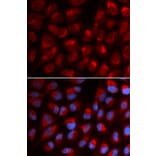 Anti-EPB41 Antibody from Bioworld Technology (BS7355) - Antibodies.com