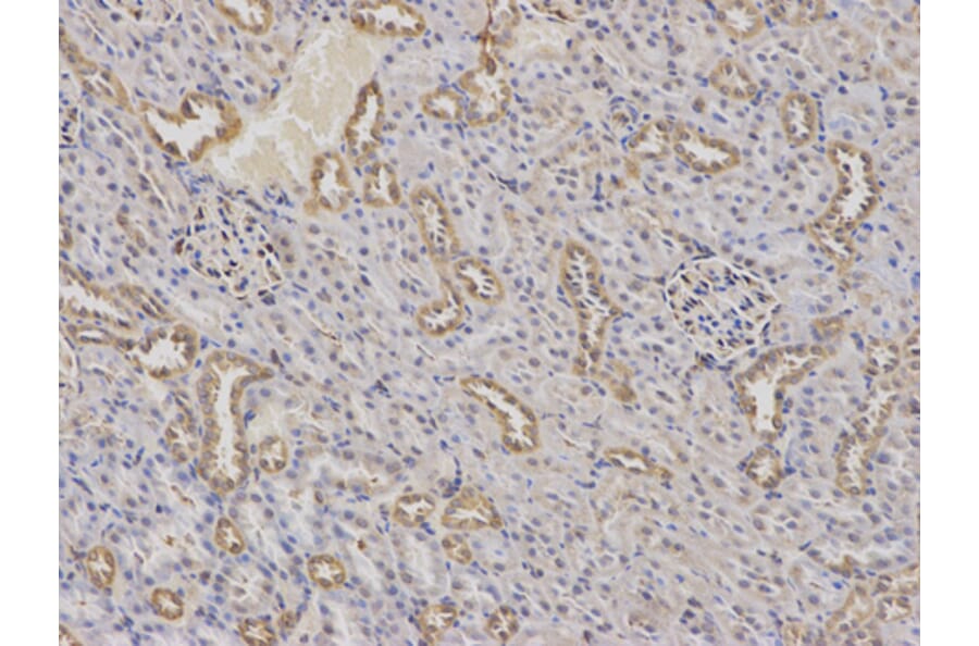Anti-AP2M1 Antibody from Bioworld Technology (BS7357) - Antibodies.com