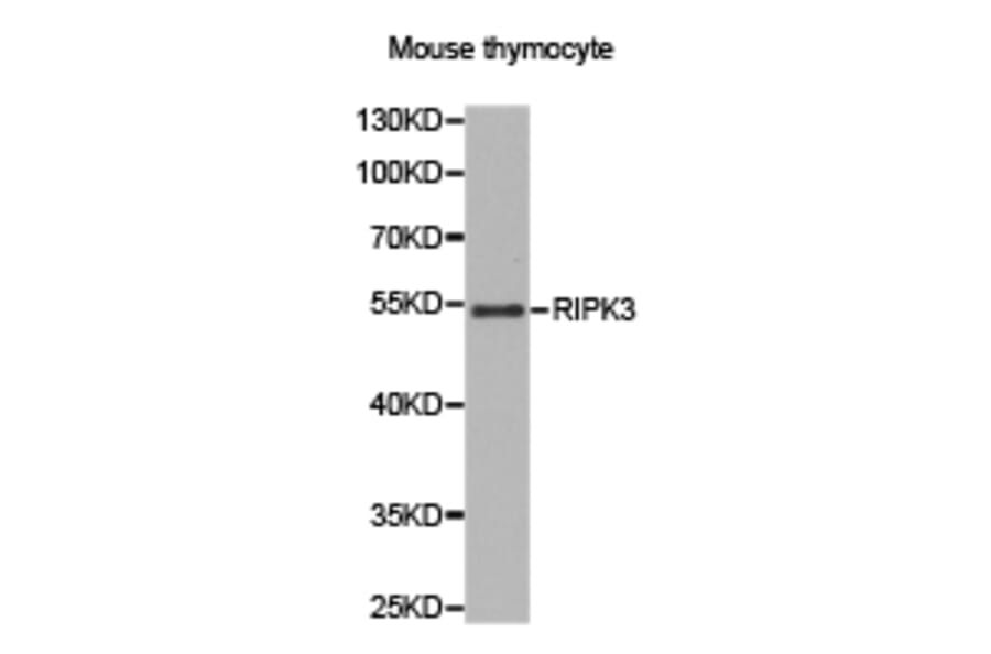 Anti-RIP3 Antibody from Bioworld Technology (BS7363) - Antibodies.com