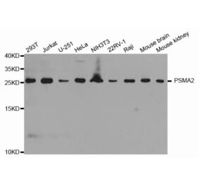 Anti-PSMA2 Antibody from Bioworld Technology (BS7364) - Antibodies.com