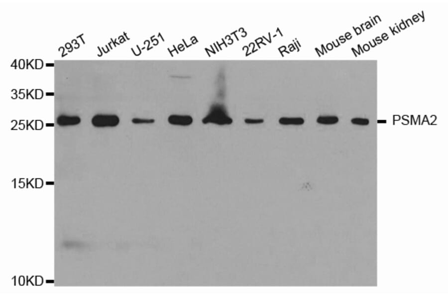 Anti-PSMA2 Antibody from Bioworld Technology (BS7364) - Antibodies.com