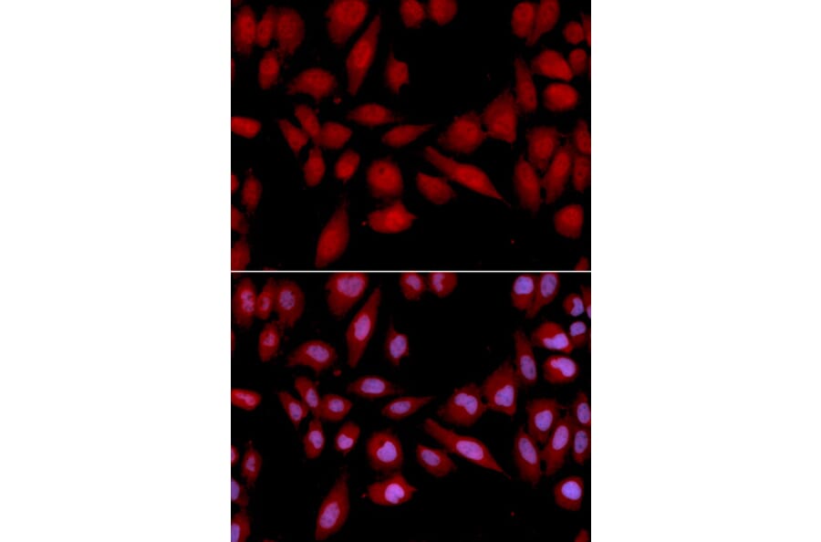 Anti-PSMA2 Antibody from Bioworld Technology (BS7364) - Antibodies.com