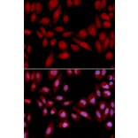 Anti-PSMA2 Antibody from Bioworld Technology (BS7364) - Antibodies.com