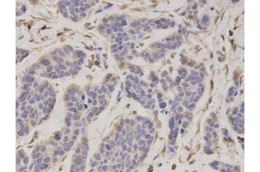 Anti-PSMC4 Antibody from Bioworld Technology (BS7365) - Antibodies.com
