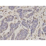 Anti-PSMC4 Antibody from Bioworld Technology (BS7365) - Antibodies.com