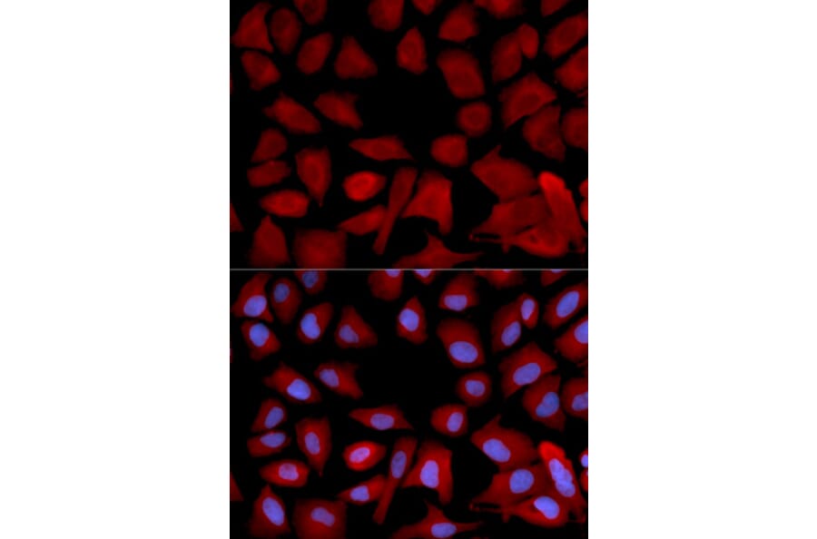 Anti-PSMC4 Antibody from Bioworld Technology (BS7365) - Antibodies.com