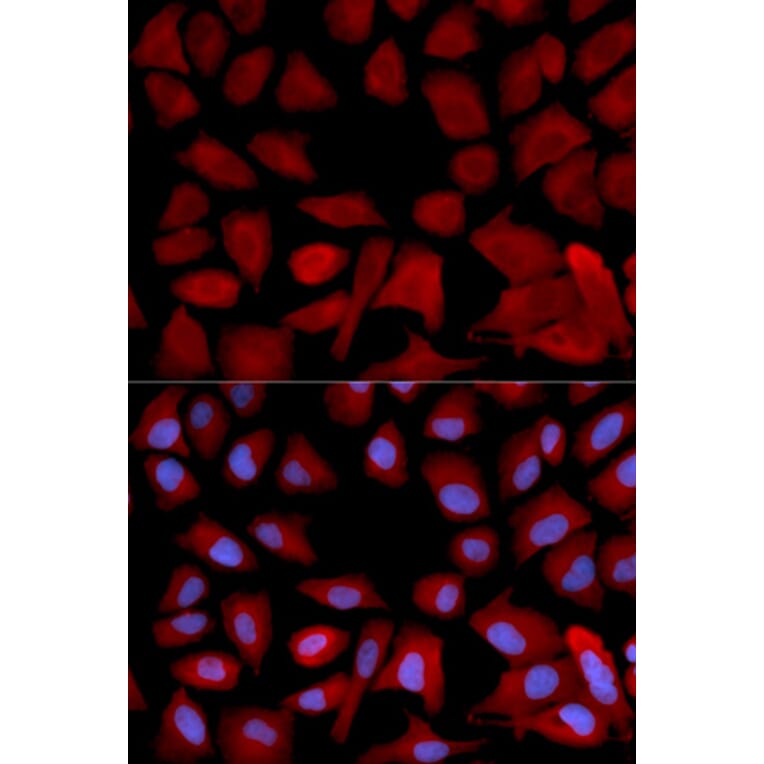 Anti-PSMC4 Antibody from Bioworld Technology (BS7365) - Antibodies.com