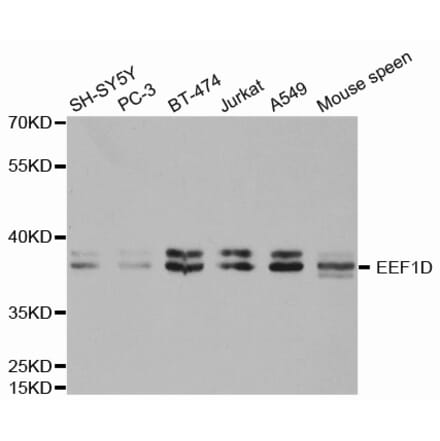 Anti-EEF1D Antibody from Bioworld Technology (BS7366) - Antibodies.com