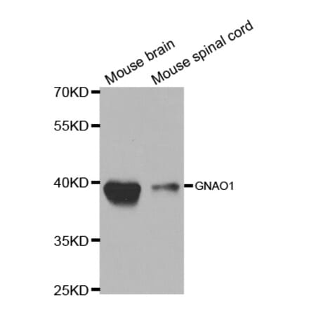 Anti-GNAO1 Antibody from Bioworld Technology (BS7367) - Antibodies.com