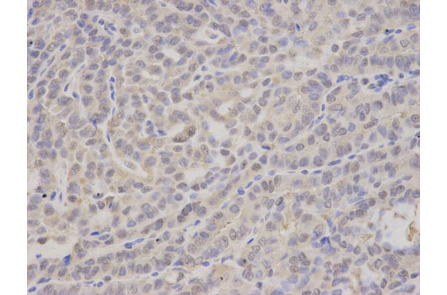 Anti-PSMA4 Antibody from Bioworld Technology (BS7368) - Antibodies.com