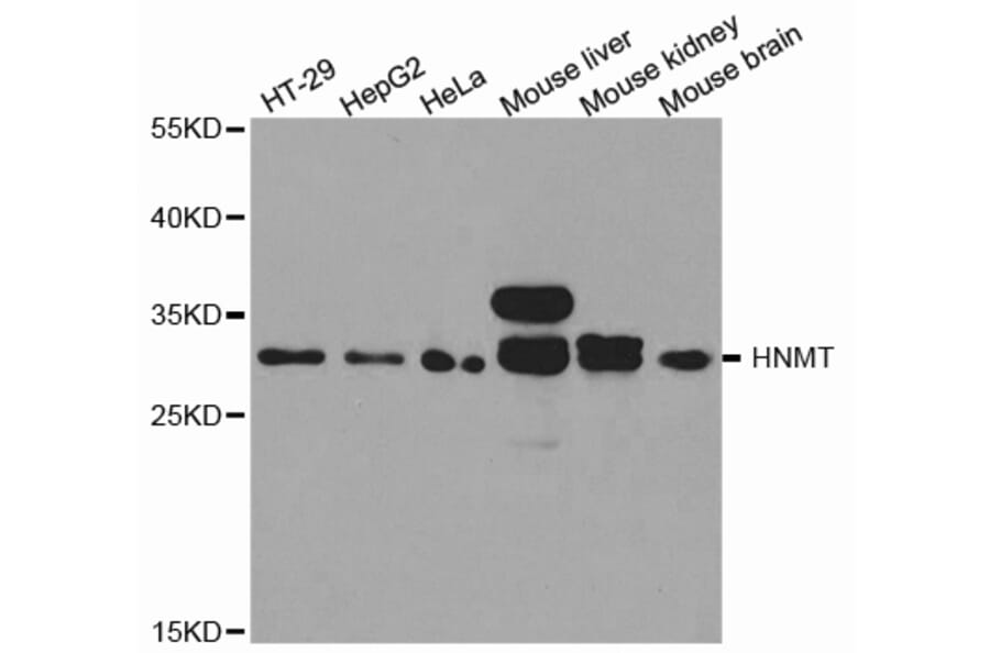 Anti-HNMT Antibody from Bioworld Technology (BS7371) - Antibodies.com