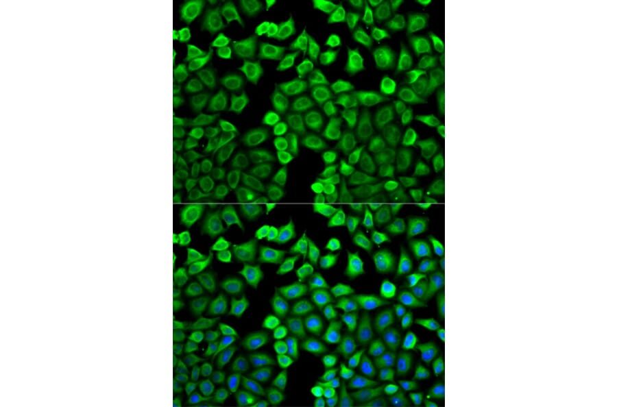 Anti-HNMT Antibody from Bioworld Technology (BS7371) - Antibodies.com