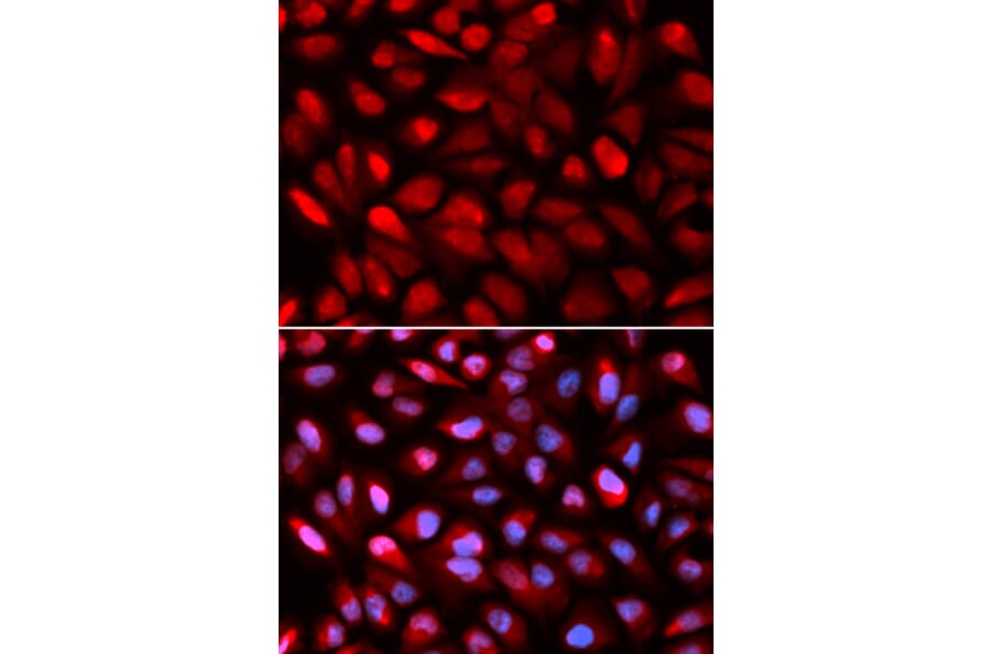 Anti-PCBP2 Antibody from Bioworld Technology (BS7376) - Antibodies.com