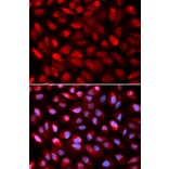 Anti-PCBP2 Antibody from Bioworld Technology (BS7376) - Antibodies.com