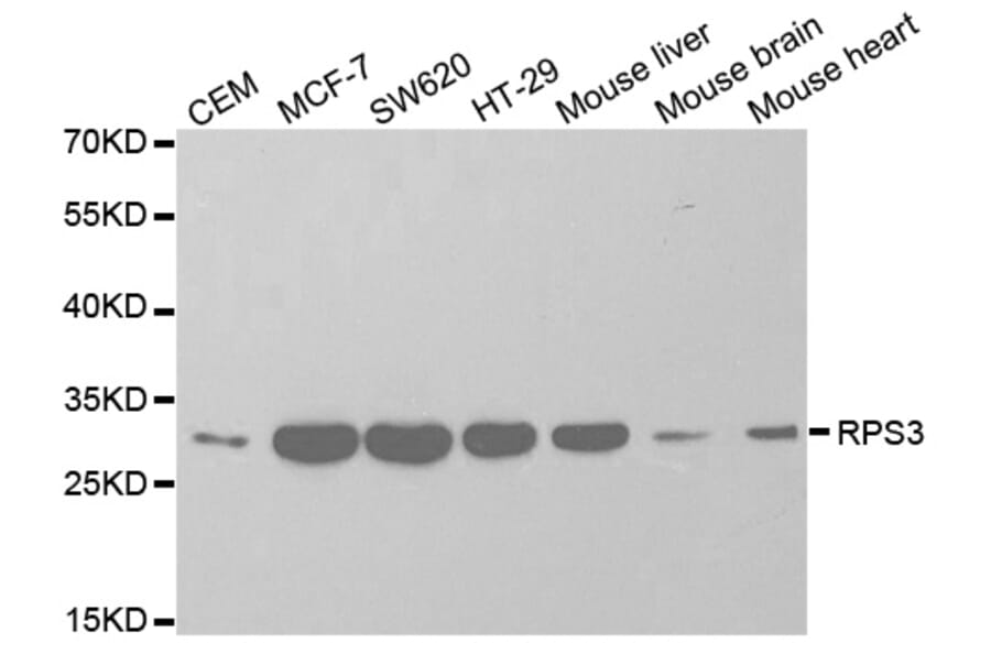 Anti-RPS3 Antibody from Bioworld Technology (BS7378) - Antibodies.com