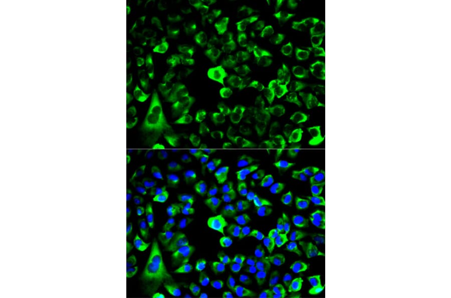 Anti-RPS3 Antibody from Bioworld Technology (BS7378) - Antibodies.com