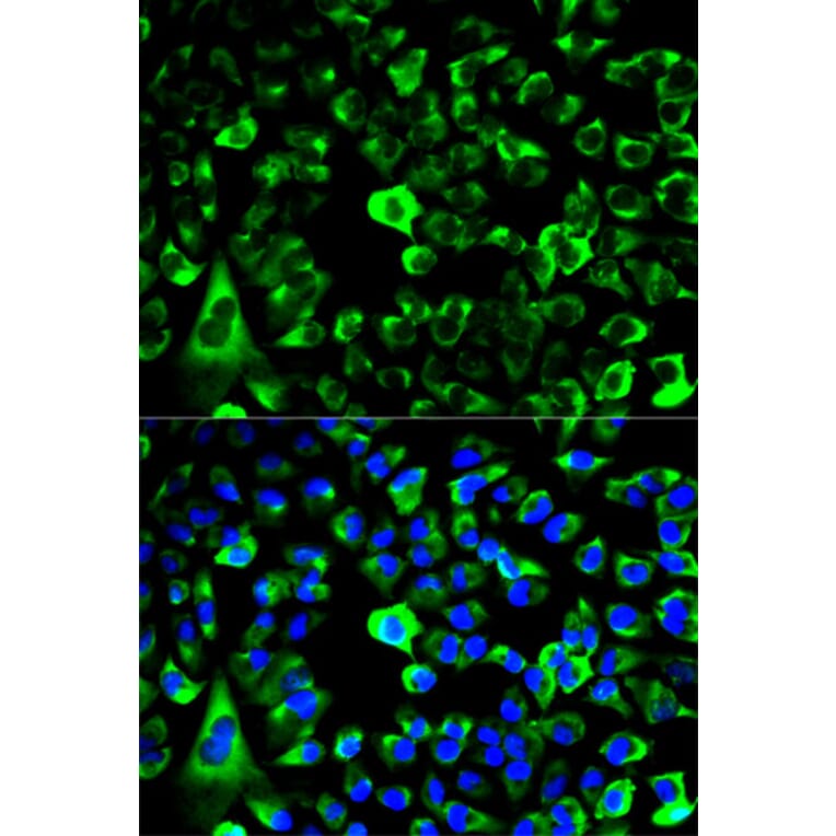 Anti-RPS3 Antibody from Bioworld Technology (BS7378) - Antibodies.com