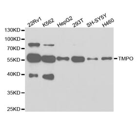 Anti-TMPO Antibody from Bioworld Technology (BS7379) - Antibodies.com