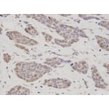 Anti-TMPO Antibody from Bioworld Technology (BS7379) - Antibodies.com