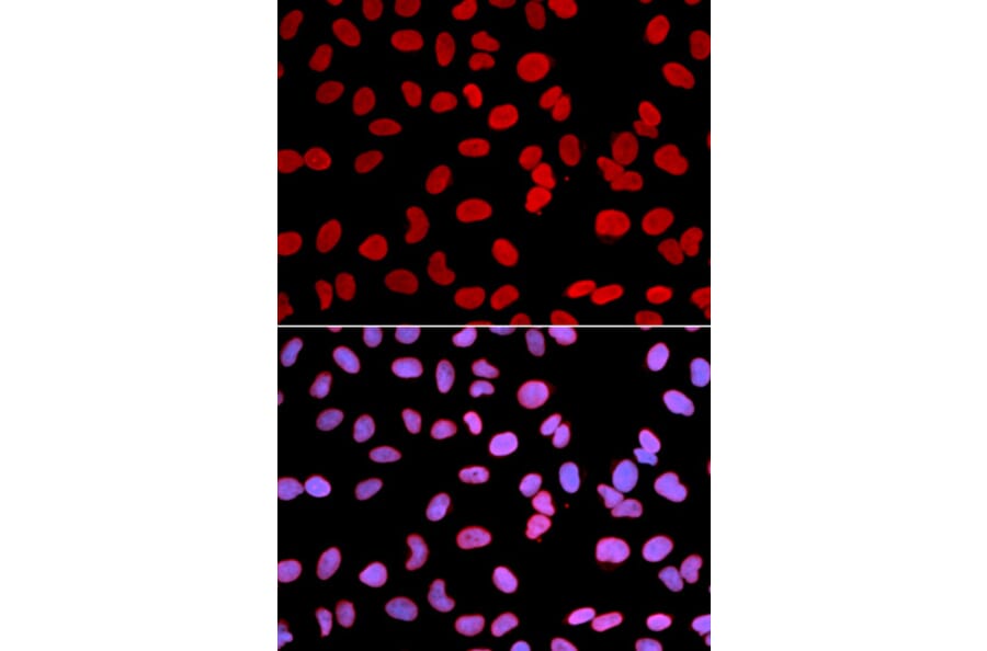 Anti-TMPO Antibody from Bioworld Technology (BS7379) - Antibodies.com