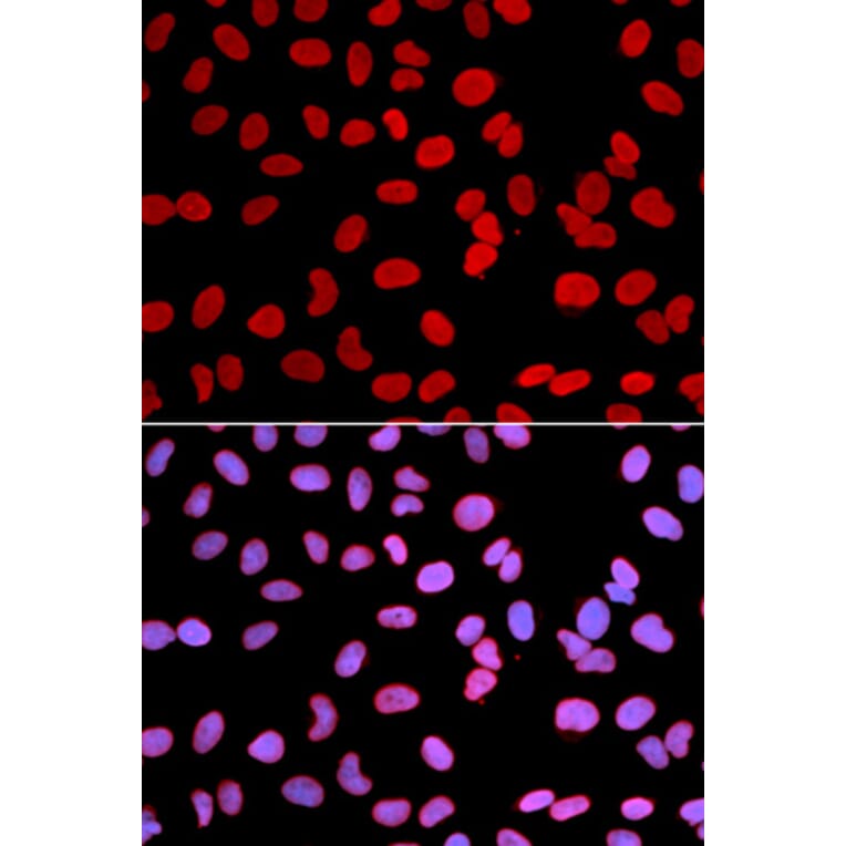 Anti-TMPO Antibody from Bioworld Technology (BS7379) - Antibodies.com