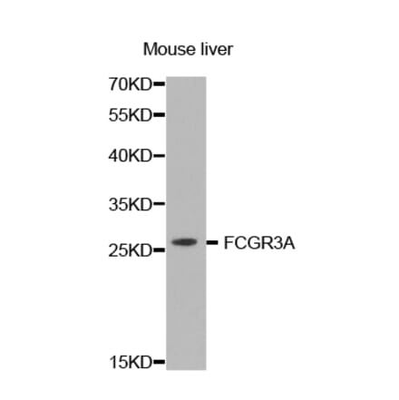 Anti-FCGR3A Antibody from Bioworld Technology (BS7381) - Antibodies.com