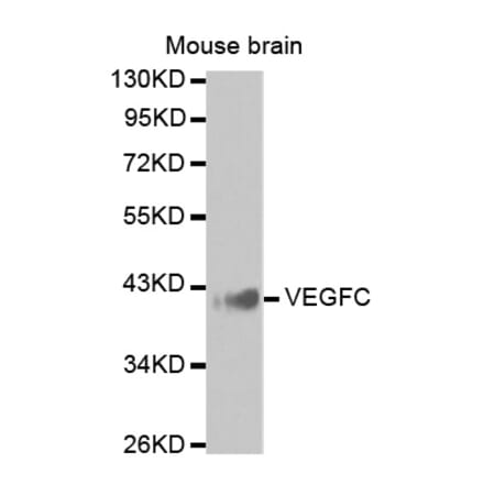 Anti-VEGFC Antibody from Bioworld Technology (BS7382) - Antibodies.com