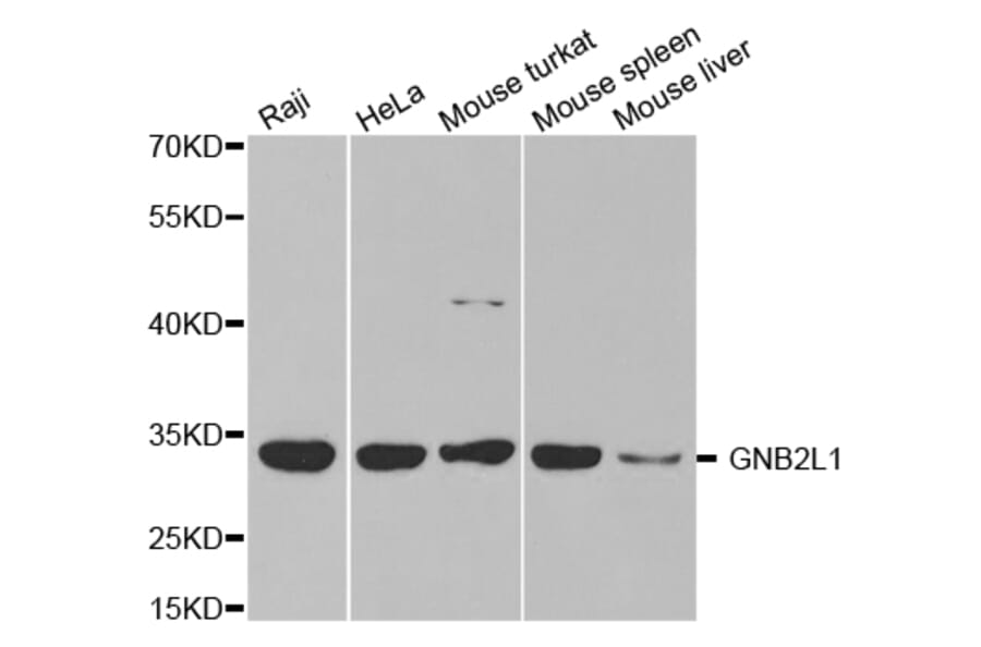 Anti-GNB2L1 Antibody from Bioworld Technology (BS7383) - Antibodies.com