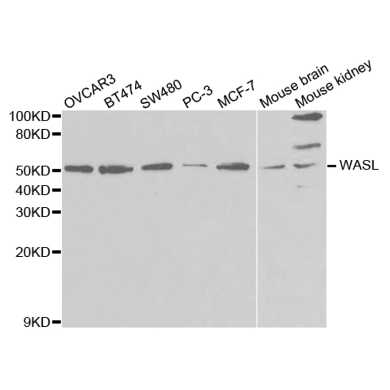 Anti-WASL Antibody from Bioworld Technology (BS7388) - Antibodies.com