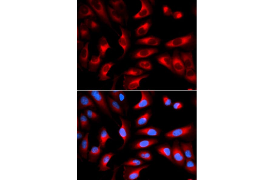 Anti-DNM1L Antibody from Bioworld Technology (BS7390) - Antibodies.com
