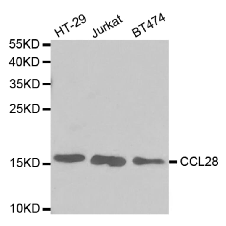Anti-CCL28 Antibody from Bioworld Technology (BS7394) - Antibodies.com