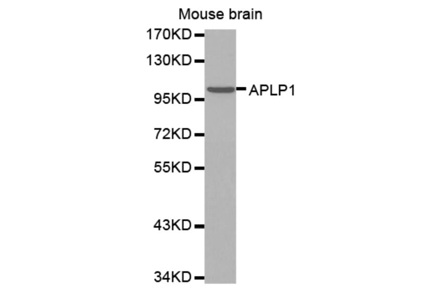 Anti-APLP1 Antibody from Bioworld Technology (BS7396) - Antibodies.com
