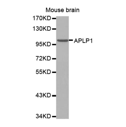 Anti-APLP1 Antibody from Bioworld Technology (BS7396) - Antibodies.com