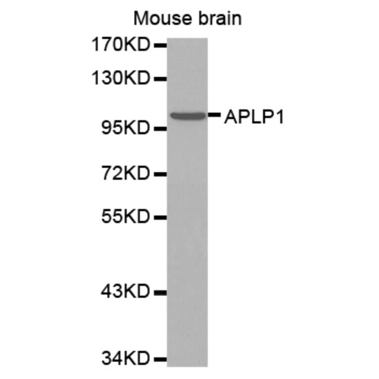 Anti-APLP1 Antibody from Bioworld Technology (BS7396) - Antibodies.com