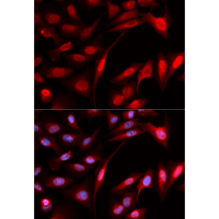 Anti-PSMB1 Antibody from Bioworld Technology (BS7397) - Antibodies.com