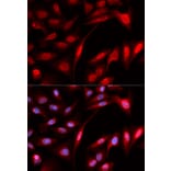 Anti-PSMB1 Antibody from Bioworld Technology (BS7397) - Antibodies.com