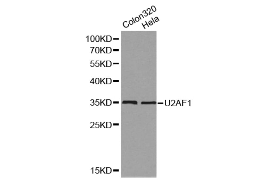 Anti-U2AF1 Antibody from Bioworld Technology (BS7399) - Antibodies.com