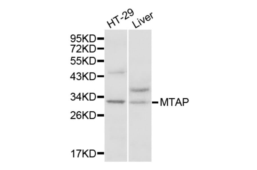 Anti-MTAP Antibody from Bioworld Technology (BS7401) - Antibodies.com