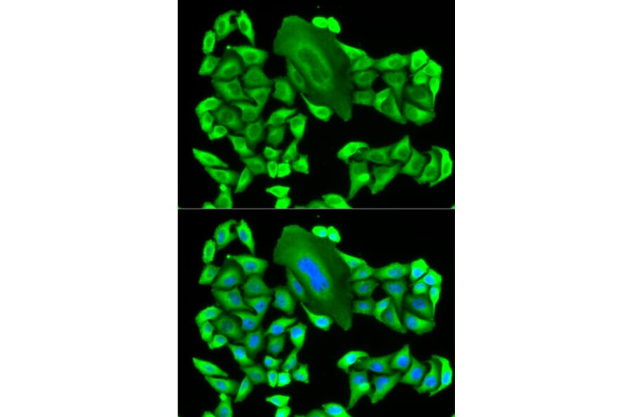 Anti-MTAP Antibody from Bioworld Technology (BS7401) - Antibodies.com
