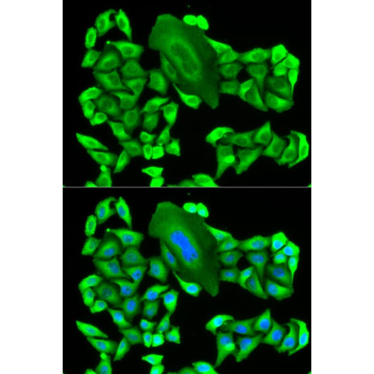 Anti-MTAP Antibody from Bioworld Technology (BS7401) - Antibodies.com