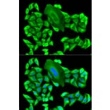 Anti-MTAP Antibody from Bioworld Technology (BS7401) - Antibodies.com