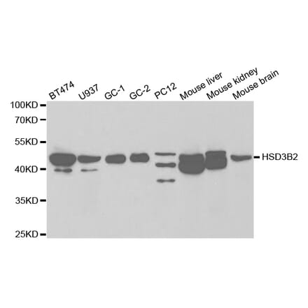 Anti-HSD3B2 Antibody from Bioworld Technology (BS7405) - Antibodies.com