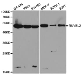 Anti-RUVBL2 Antibody from Bioworld Technology (BS7408) - Antibodies.com