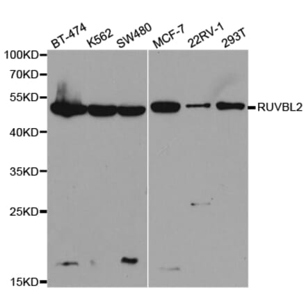 Anti-RUVBL2 Antibody from Bioworld Technology (BS7408) - Antibodies.com
