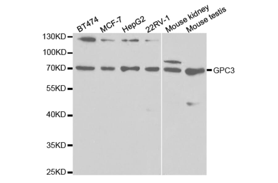 Anti-GPC3 Antibody from Bioworld Technology (BS7410) - Antibodies.com