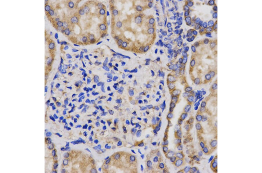 Anti-GPC3 Antibody from Bioworld Technology (BS7410) - Antibodies.com
