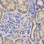 Anti-GPC3 Antibody from Bioworld Technology (BS7410) - Antibodies.com